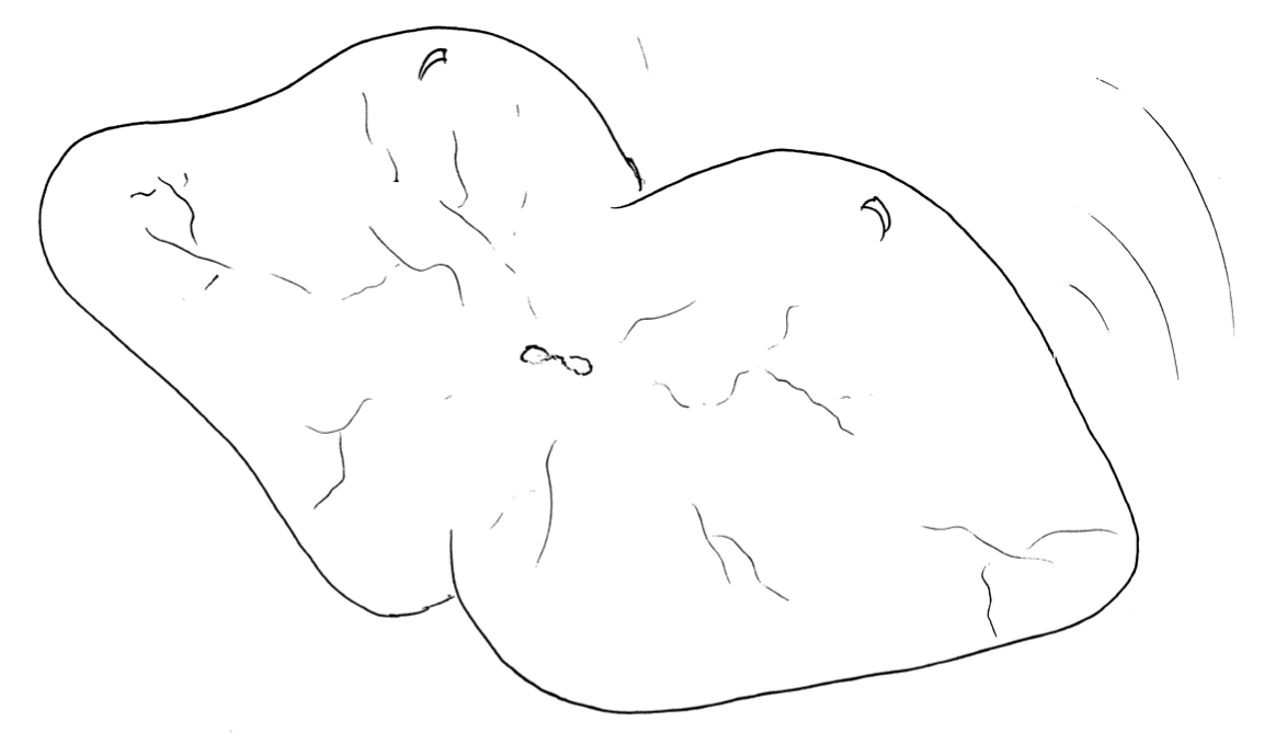 Hand-drawn sketch depicting heavily damaged female reproductive material with lines representing micro-lacerations